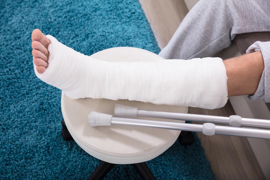 Find out how a California fractured and broken bones lawyer can help you recover the compensation you need for your injury.